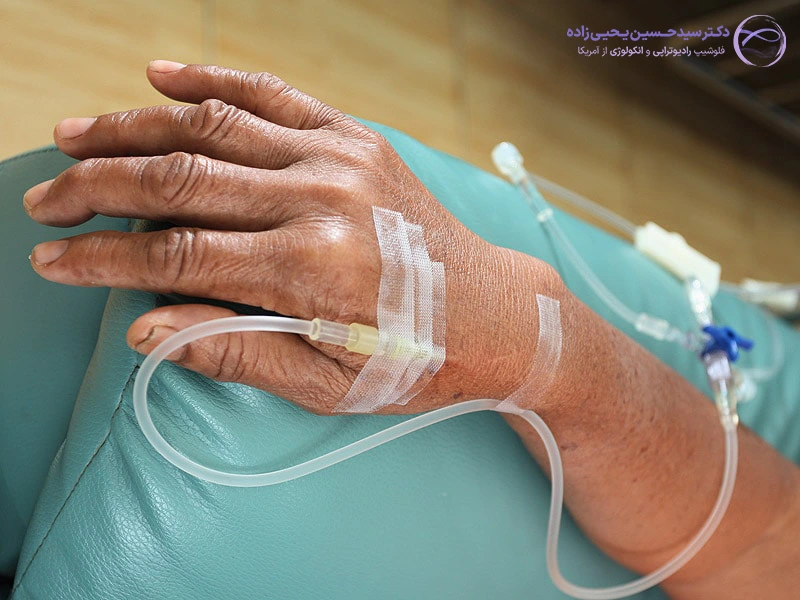 شیمی درمانی